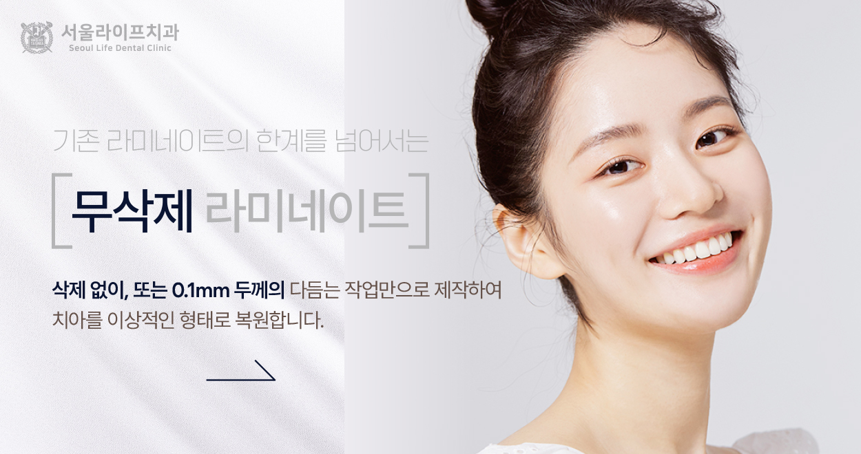 무삭제 라미네이트